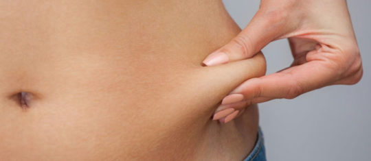 abdominoplastie