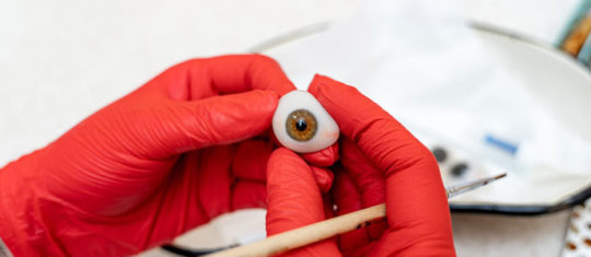prothèse oculaire